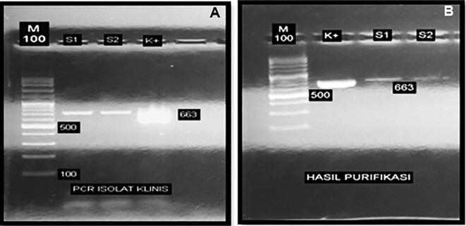 Cloning and expression of MPT83 gene from Mycobacterium tuberculosis in E. coli BL21 as vaccine candidate of tuberculosis: A preliminary study