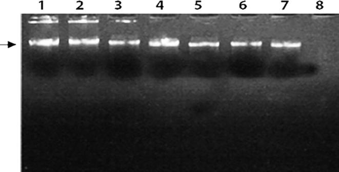 Cloning and expression of MPT83 gene from Mycobacterium tuberculosis in E. coli BL21 as vaccine candidate of tuberculosis: A preliminary study