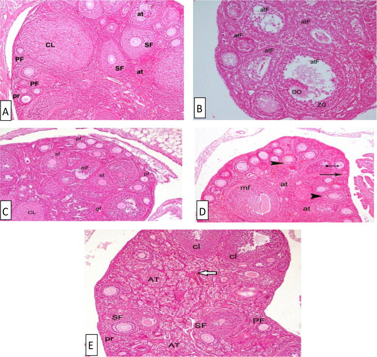 Evaluation of the alleviative role of Chlorella vulgaris and Spirulina platensis extract against ovarian dysfunctions induced by monosodium glutamate in mice