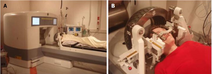 Radiosurgical techniques for the treatment of brain neoplasms: A short review.