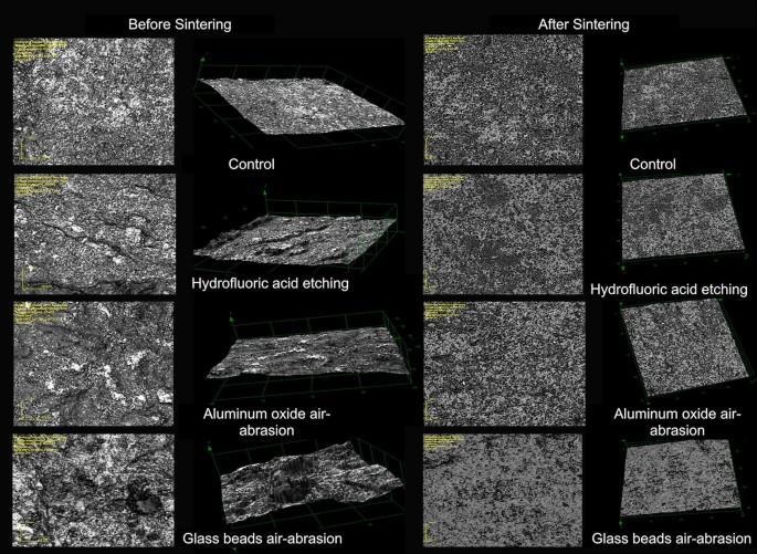 Surface topography and bond strength of CAD–CAM milled zirconia ceramic luted onto human dentin: effect of surface treatments before and after sintering