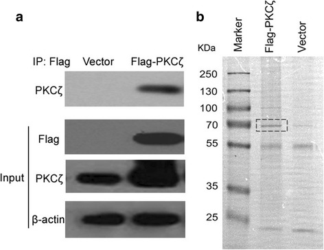 Profiling the interactome of protein kinase C ζ by proteomics and bioinformatics.