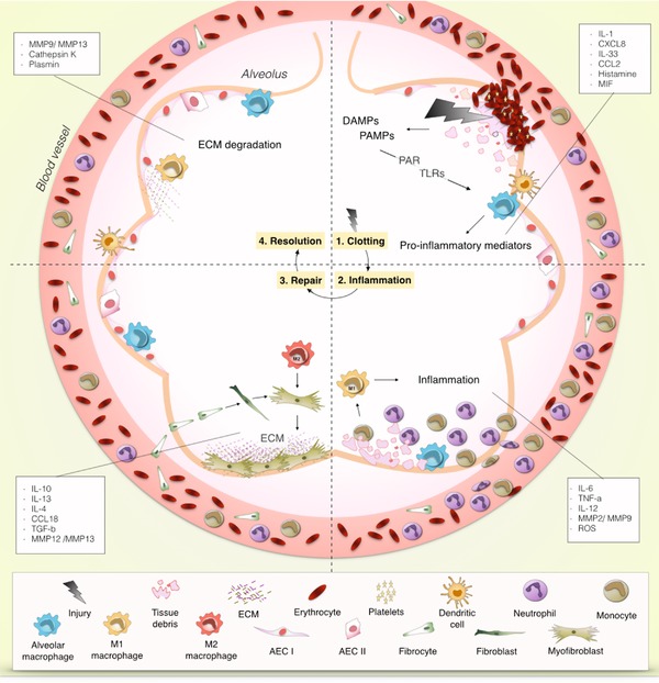 The diversity of myeloid immune cells shaping wound repair and fibrosis in the lung.