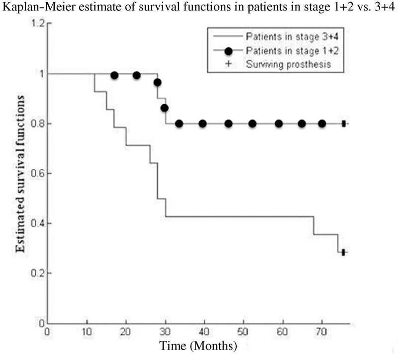 Survival Analysis after Core Decompression in Association with Platelet-Rich Plasma, Mesenchymal Stem Cells, and Synthetic Bone Graft in Patients with Osteonecrosis of the Femoral Head.