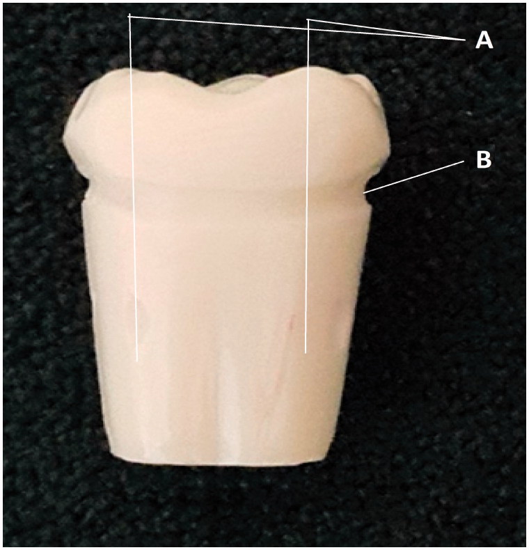 <i>In vitro</i> analysis of the marginal adaptation and discrepancy of stainless steel crowns.