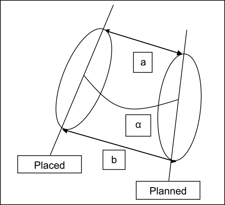 Accuracy of Guided Surgery via Stereolithographic Mucosa-Supported Surgical Guide in Implant Surgery for Edentulous Patient: a Systematic Review.