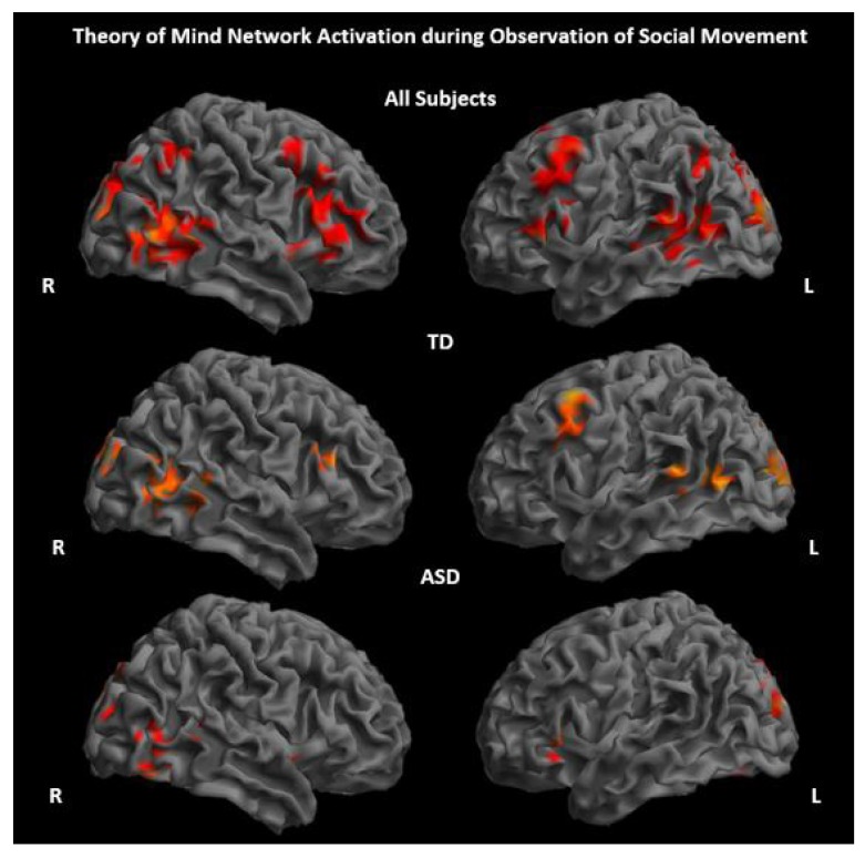 Brain Responses Underlying Anthropomorphism, Agency, and Social Attribution in Autism Spectrum Disorder.