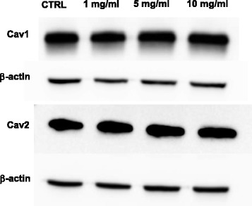 In vitro gentamicin exposure alters caveolae protein profile in cochlear spiral ligament pericytes.