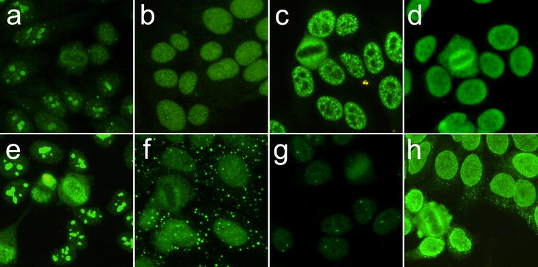 Bench to bedside review of myositis autoantibodies.