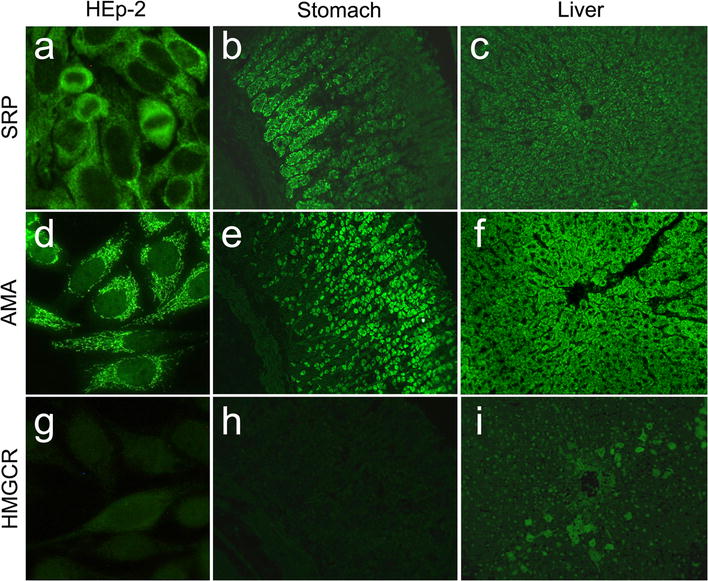 Bench to bedside review of myositis autoantibodies.