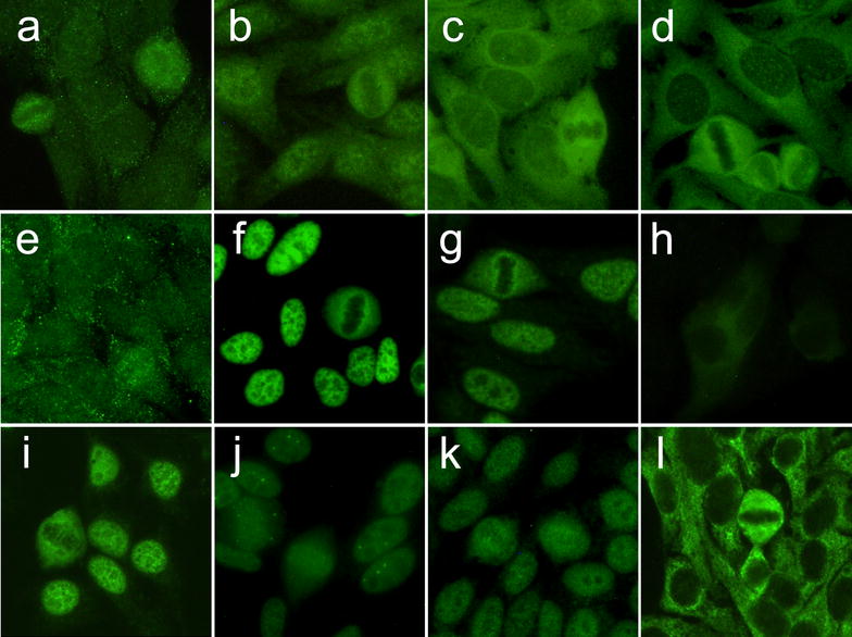 Bench to bedside review of myositis autoantibodies.