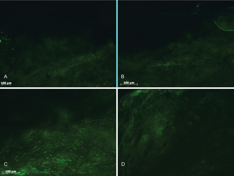 Migration of Mesenchymal Stem Cells of Bursal Tissue after Rotator Cuff Repair in Rats.