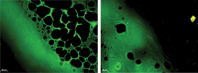 Migration of Mesenchymal Stem Cells of Bursal Tissue after Rotator Cuff Repair in Rats.