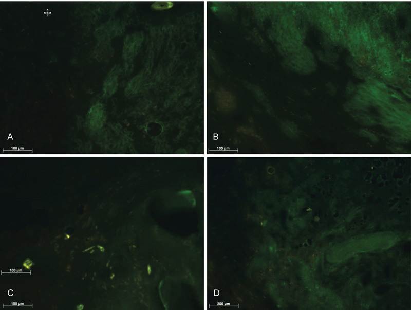 Migration of Mesenchymal Stem Cells of Bursal Tissue after Rotator Cuff Repair in Rats.