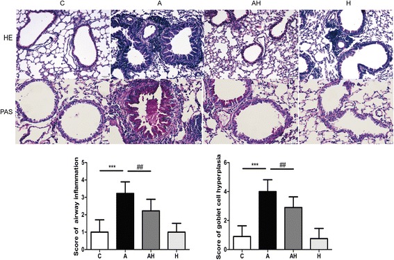 Inhalation of hydrogen gas attenuates airway inflammation and oxidative stress in allergic asthmatic mice.