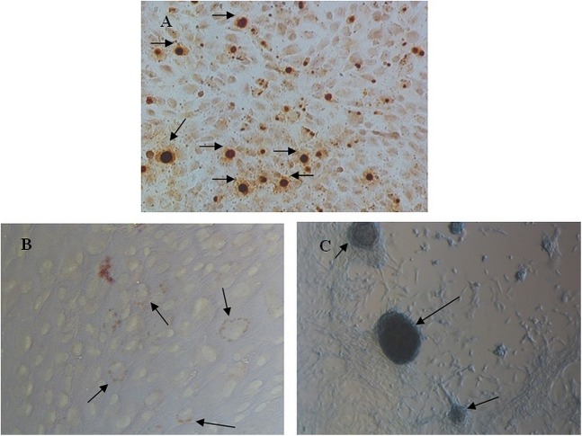 Establishing methods for isolation of stem cells from human exfoliated deciduous from carious deciduous teeth.