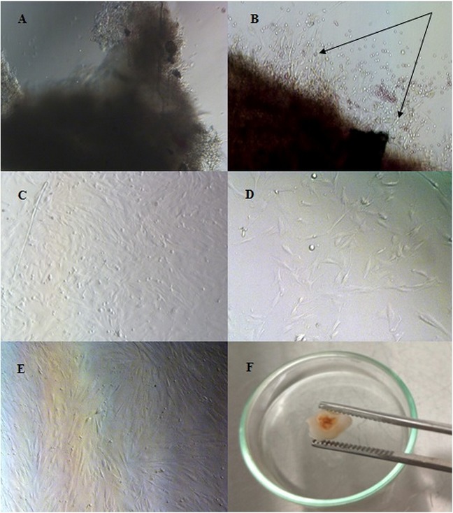 Establishing methods for isolation of stem cells from human exfoliated deciduous from carious deciduous teeth.