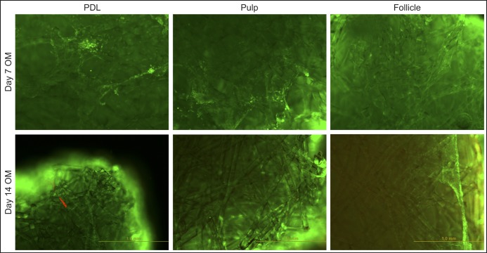 Dental Stem Cells Harvested from Third Molars Combined with Bioactive Glass Can Induce Signs of Bone Formation In Vitro.