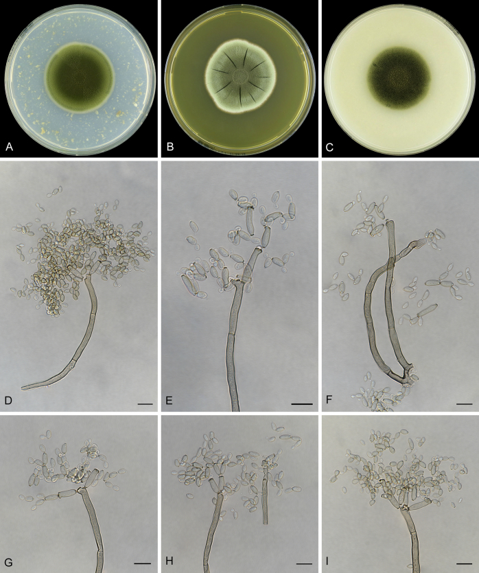 Cladosporium species in indoor environments