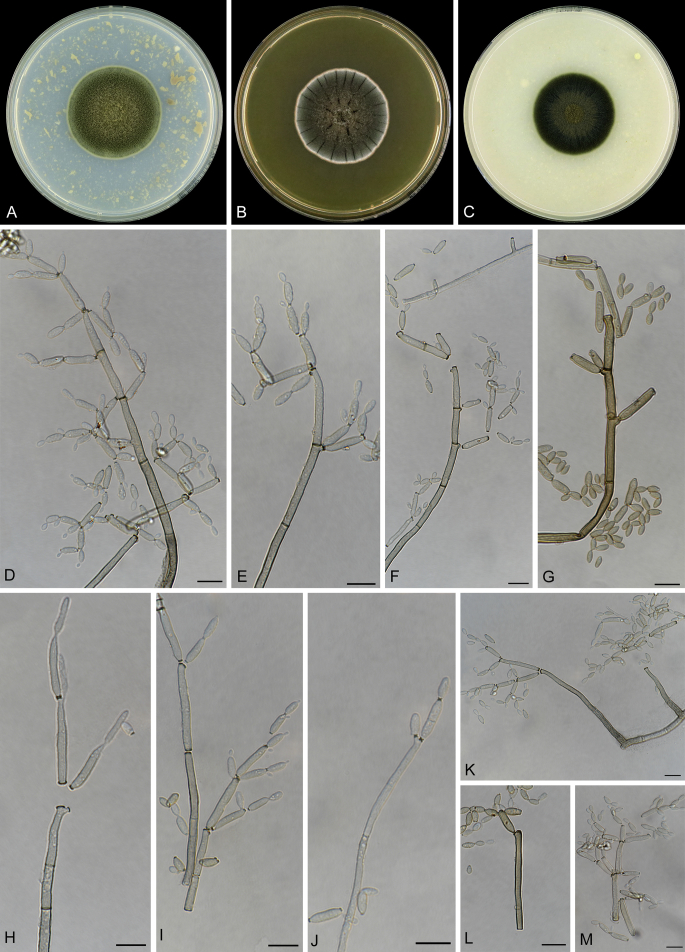 Cladosporium species in indoor environments