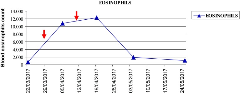 Hyperprogressive Disease and Early Hypereosinophilia After Anti-PD-1 Treatment: A Case Report.