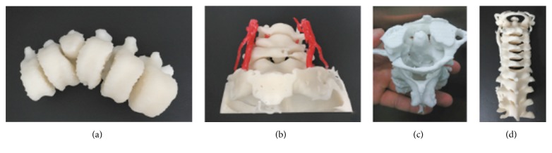 3D Printing Applications in Minimally Invasive Spine Surgery.