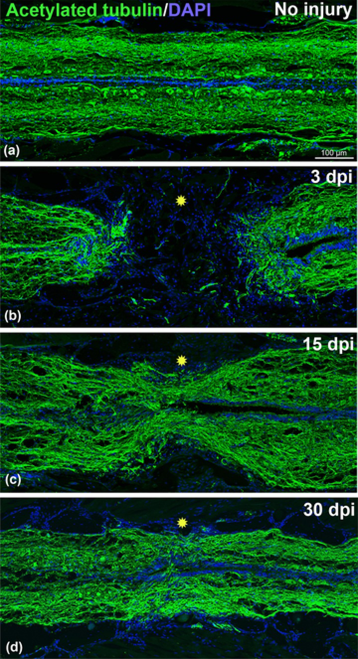 Axonal regeneration in zebrafish spinal cord.