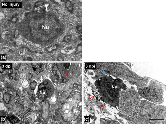 Axonal regeneration in zebrafish spinal cord.