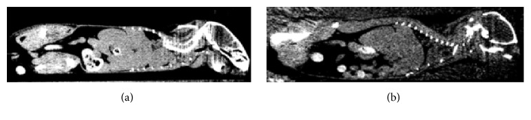 Cryo-Imaging and Software Platform for Analysis of Molecular MR Imaging of Micrometastases.