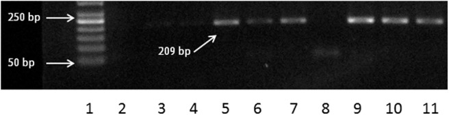 Analysis of differential expression of protease-activated receptors in patients with allergic fungal rhinosinusitis.