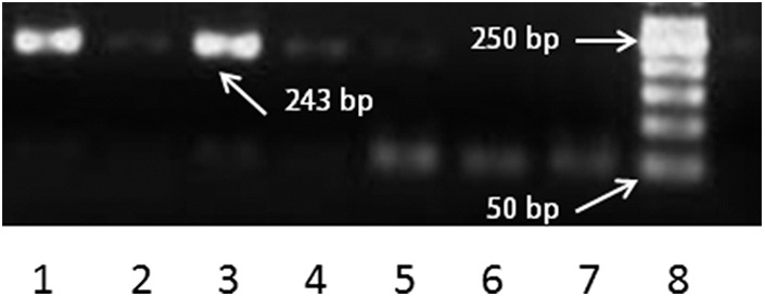 Analysis of differential expression of protease-activated receptors in patients with allergic fungal rhinosinusitis.