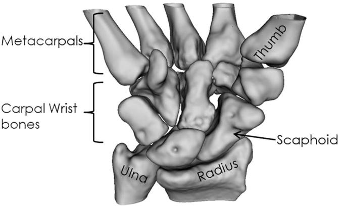 Analysis of instability patterns in acute scaphoid fractures by 4-dimensional computed tomographic imaging – A prospective cohort pilot study protocol