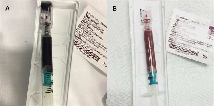 Acquired Methemoglobinemia Associated with Topical Lidocaine Administration: A Case Report.