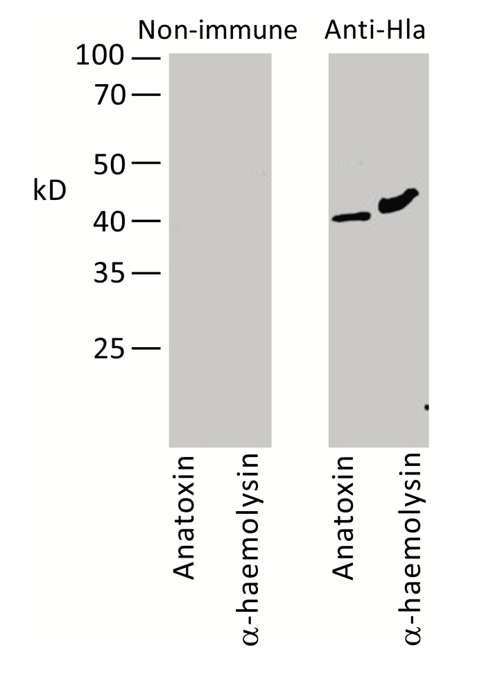 <i>Staphylococcus Aureus</i> Surface Protein G is An Immunodominant Protein and a Possible Target in An Anti-Biofilm Drug Development.