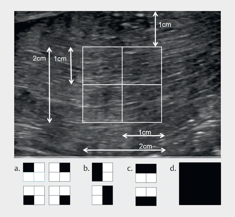 Influencing Factors of 2D Shear Wave Elastography of the Muscle - An Ex Vivo Animal Study.