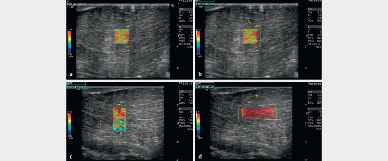 Influencing Factors of 2D Shear Wave Elastography of the Muscle - An Ex Vivo Animal Study.