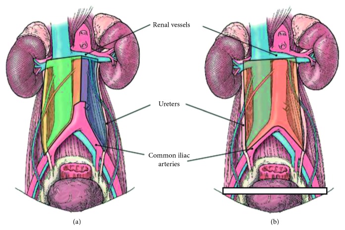 The Use of Modified Templates in Early and Advanced Stage Nonseminomatous Germ Cell Tumor.