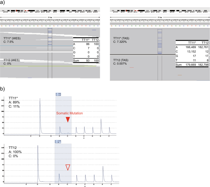 Identification of somatic mutations in monozygotic twins discordant for psychiatric disorders.