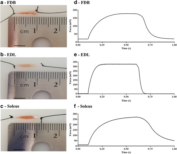 Characterization and utilization of the flexor digitorum brevis for assessing skeletal muscle function.