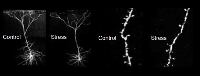 The Dazzling Promise of Ketamine.