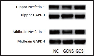 The Level of Nesfatin-1 in a Mouse Gastric Cancer Model and Its Role in Gastric Cancer Comorbid with Depression.