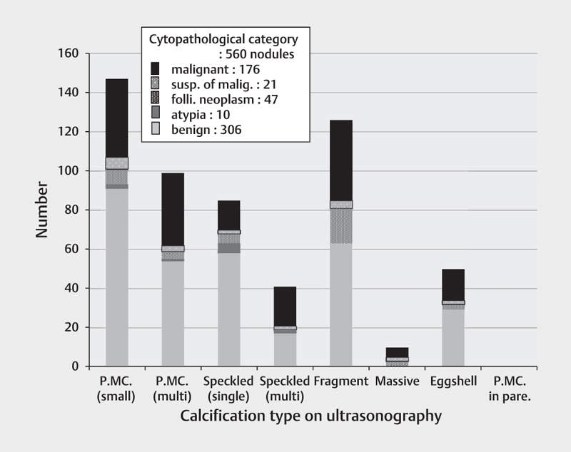 Calcifications in Thyroid Tumors on Ultrasonography: Calcification Types and Relationship with Histopathological Type.