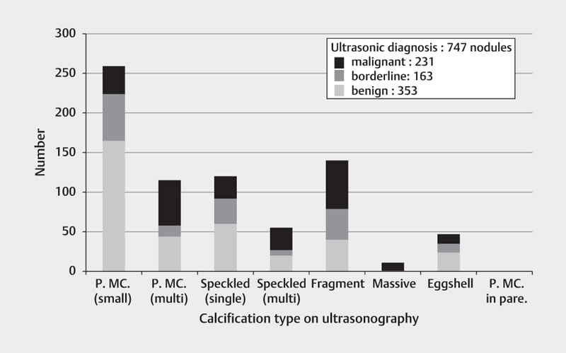 Calcifications in Thyroid Tumors on Ultrasonography: Calcification Types and Relationship with Histopathological Type.