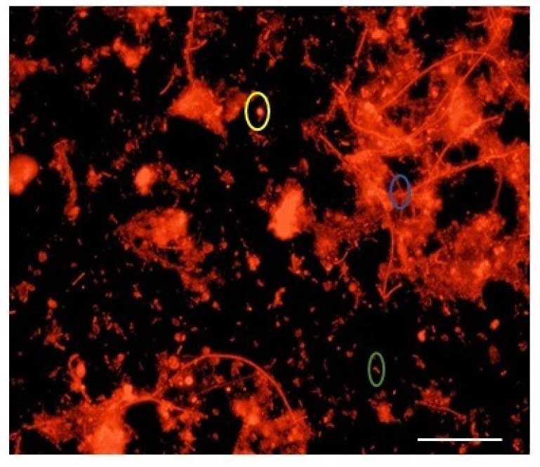 Assessing Methanogenic Archaeal Community in Full Scale Anaerobic Sludge Digester Systems in Dubai, United Arab Emirates.