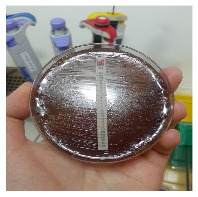 Diagnosis of <i>Helicobacter pylori</i> Using Invasive and Noninvasive Approaches.