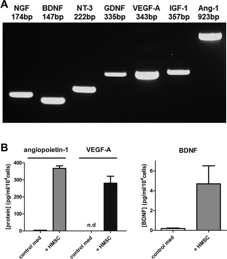 Long-Term Effects of Fibrin Conduit with Human Mesenchymal Stem Cells and Immunosuppression after Peripheral Nerve Repair in a Xenogenic Model.