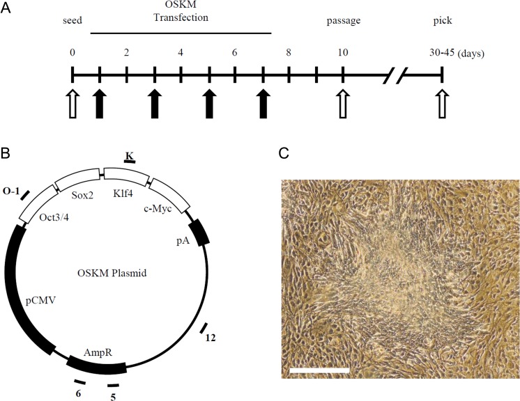 The Development of Cancer through the Transient Overexpression of Reprogramming Factors.