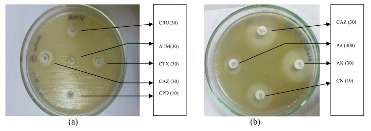 Enumerating Antibiotic Susceptibility Patterns of <i>Pseudomonas aeruginosa</i> Isolated from Different Sources in Dhaka City.