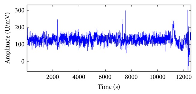 Effects of Fatigue Based on Electroencephalography Signal during Laparoscopic Surgical Simulation.