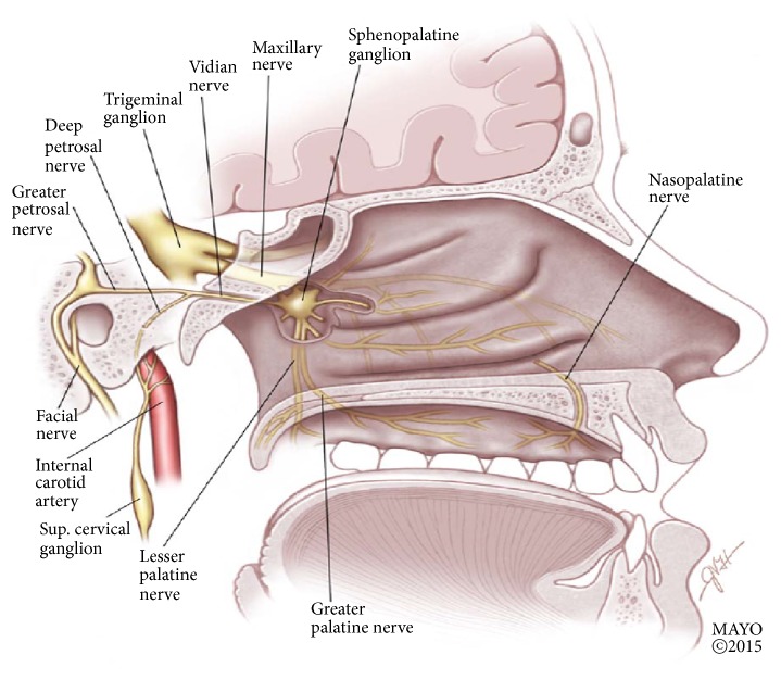 Sphenopalatine Ganglion Block for the Treatment of Acute Migraine Headache.